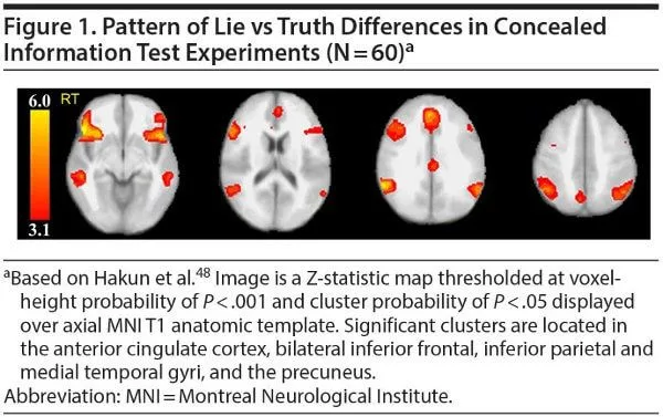 telerradiologia, laudos a distância, fMRI