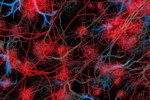 fMRI supera polígrafo na detecção de mentiras | STAR Telerradiologia 1