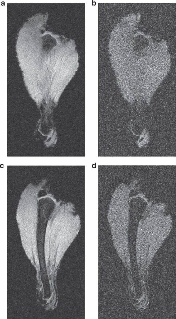 O uso de metamateriais e a evolução da ressonancia magnetica2