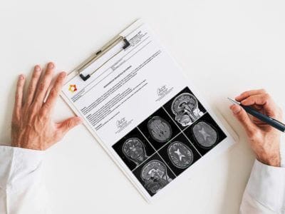 Elaboração de laudos médicos - Reduzir o Tempo de Entrega de Laudos em um serviço de Radiologia