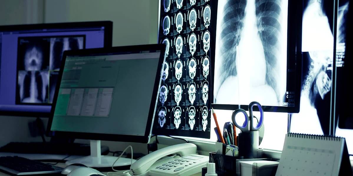 Telerradiologia o que e 3 e1779078111485 Exames de imagem exibidos em monitor para prática de telerradiologia