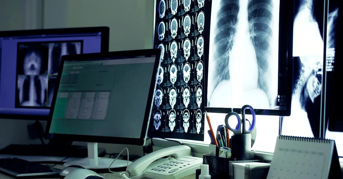 Telerradiologia o que e 3 Exames de imagem exibidos em monitor para prática de telerradiologia