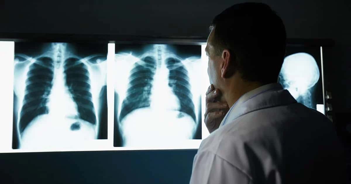 médico interpretando exame de raio x