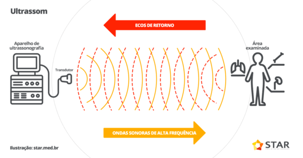 Ultrassonografia: Como Funciona O Exame De Ultrassom