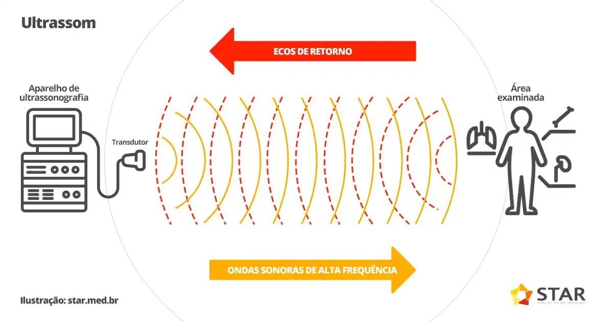 Aprendendo sobre ultrassonografia no sistema locomotor - artefatos