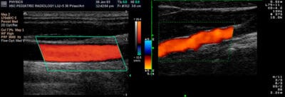 Ultrassonografia: Como Funciona O Exame De Ultrassom