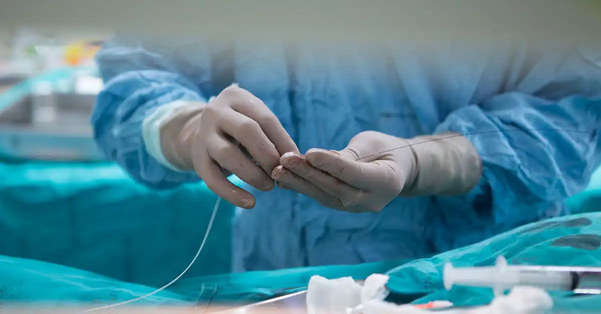 exame de angiografia sendo realizado