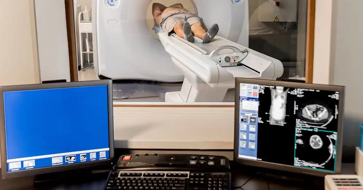 tomografia computadorizada