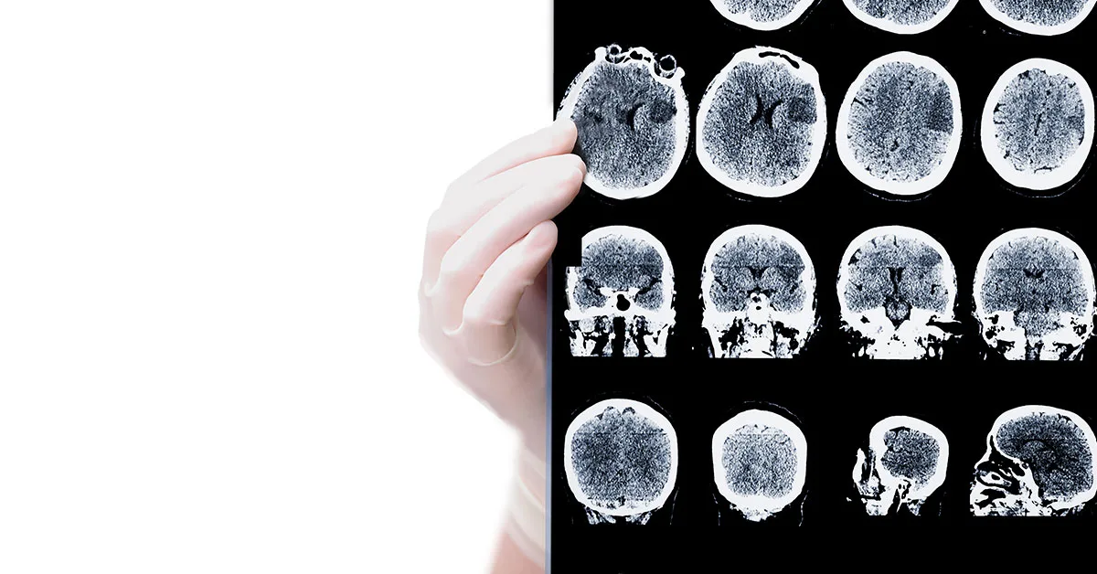 medico avaliando tc do cranio medico avaliando tc de cranio