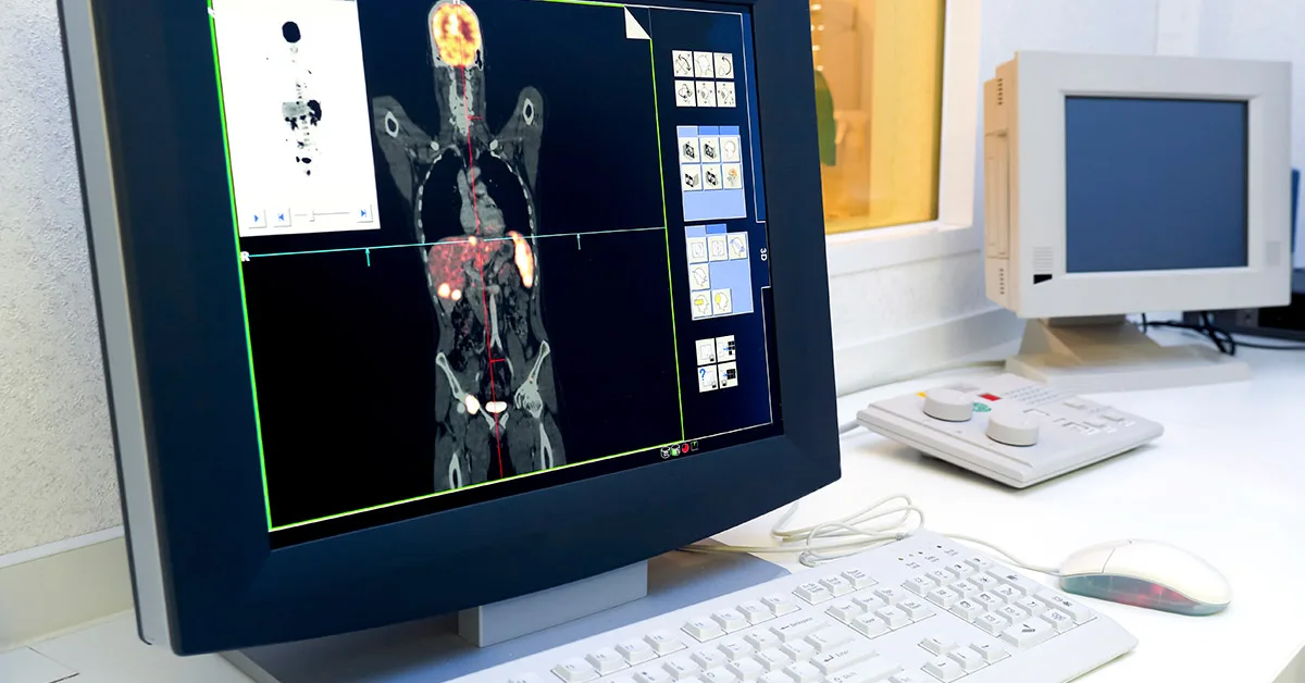 monitor medico monitor médico