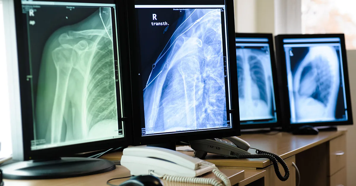 monitores-médicos-para-exames-radiológicos monitores médicos para exames radiológicos