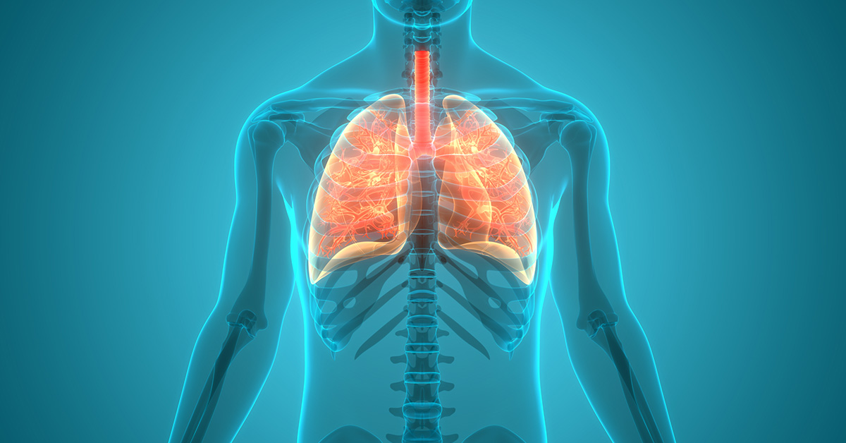 demonstracao 3d fibrose pulmonar