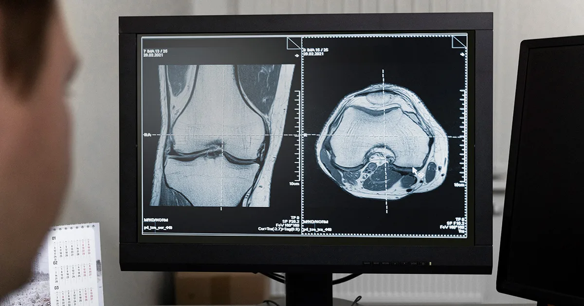 monitor de radiologia especializada