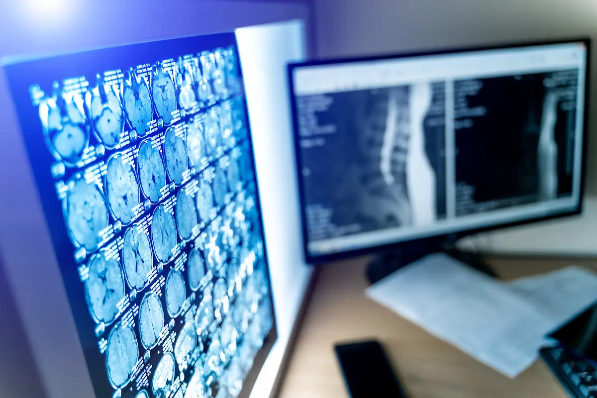 inspecionando a qualidade dos laudos no monitor