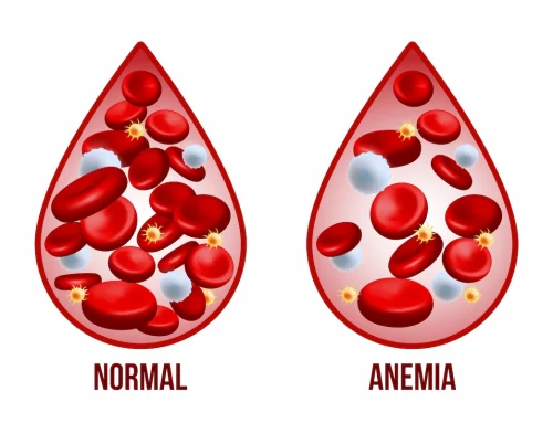 Anemia: o que é, o que causa e tratamento