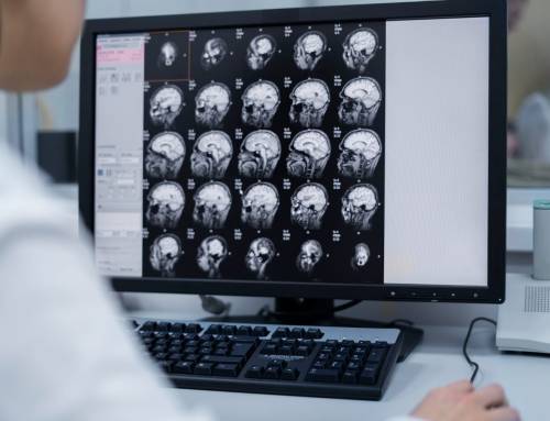 Neurorradiologia: como funciona e sua importância
