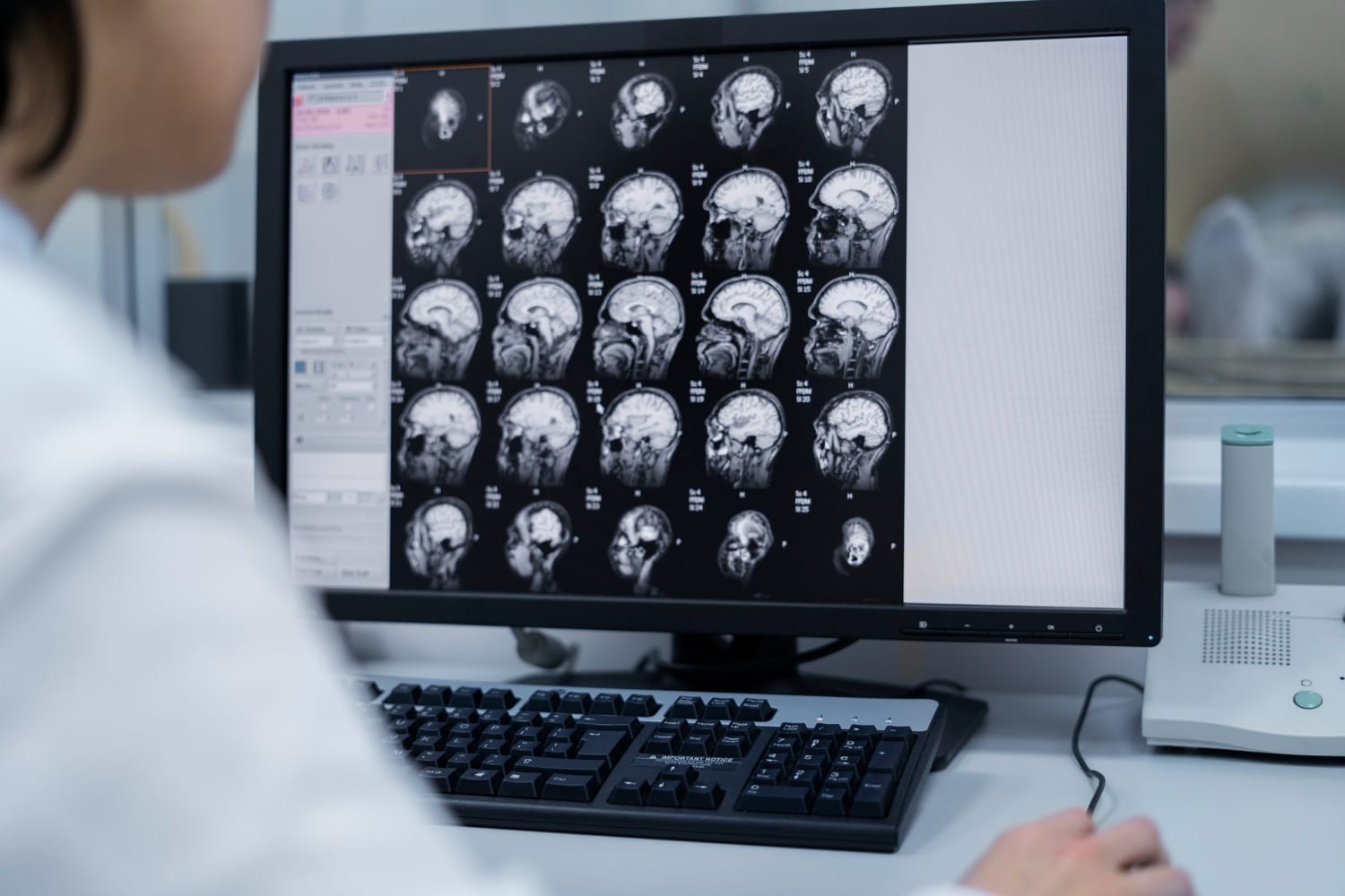 Médico especializado em neurorradiologia analisando um exame Médico especializado em neurorradiologia analisando um exame