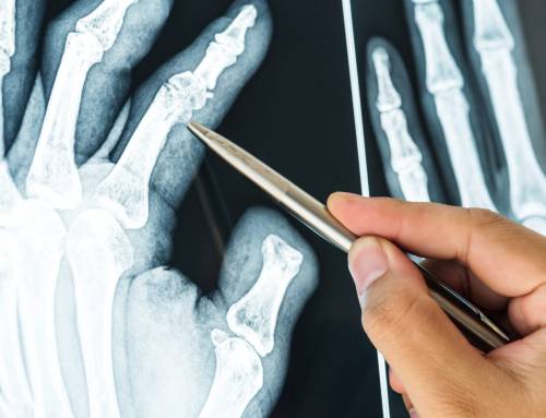 Radiologia Musculoesquelética: o que é e o que examina?